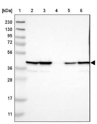 Western Blot: UBXN1 Antibody [NBP1-89387]