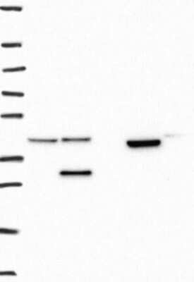 Western Blot: UBXN1 Antibody [NBP3-17958]