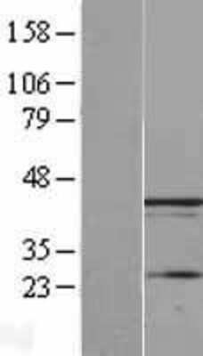 Western Blot: UBXN1 Overexpression Lysate [NBL1-12613]