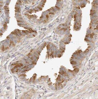 Immunohistochemistry-Paraffin: UBXN10 Antibody [NBP1-83561]