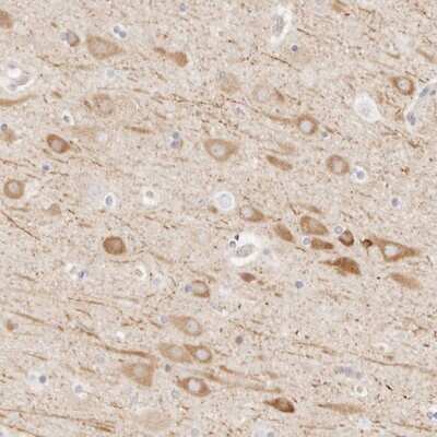 Immunohistochemistry-Paraffin: UBXN10 Antibody [NBP1-83562]