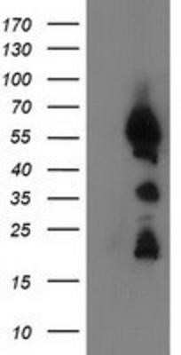 Western Blot: UBXN2B Antibody (OTI1F7)Azide and BSA Free [NBP2-74769]