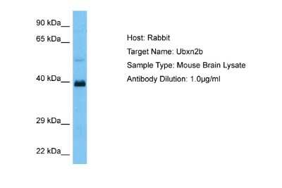 Western Blot: UBXN2B Antibody [NBP2-86038]