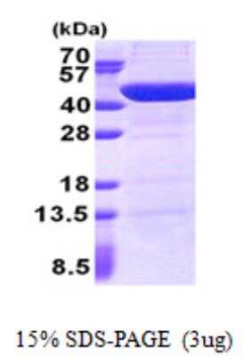 SDS-PAGE: Recombinant Human UBXN2B His Protein [NBP2-22927]