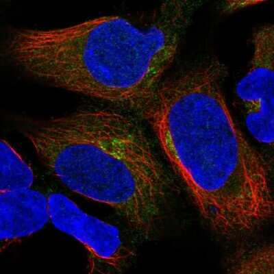 Immunocytochemistry/ Immunofluorescence: UBXN6 Antibody [NBP2-57653]