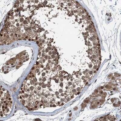 Immunohistochemistry-Paraffin: UBXN6 Antibody [NBP1-80648]