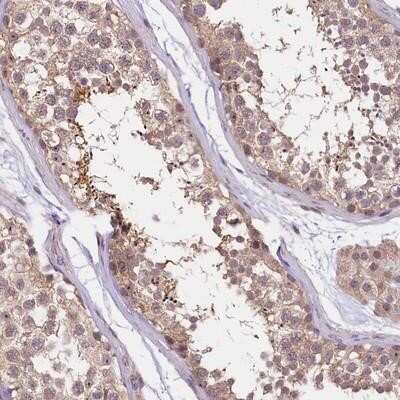 Immunohistochemistry-Paraffin: UBXN6 Antibody [NBP1-80649]