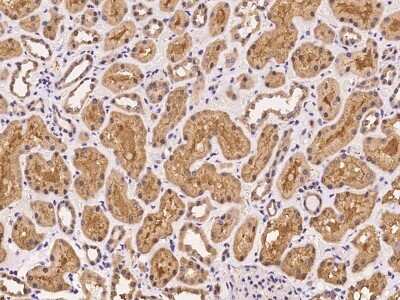 Immunohistochemistry-Paraffin: UBXN6 Antibody [NBP2-97298]