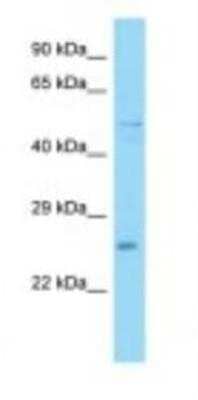 Western Blot: UBXN6 Antibody [NBP1-98481]