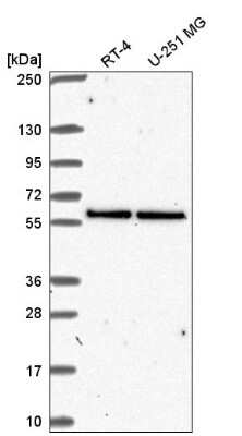 Western Blot: UBXN6 Antibody [NBP2-57653]