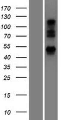 Western Blot: UBXN6 Overexpression Lysate [NBP2-06215]