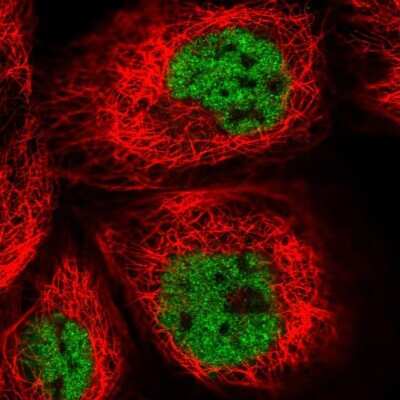 Immunocytochemistry/ Immunofluorescence: UBXN7 Antibody [NBP2-47588]