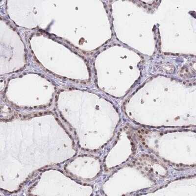 Immunohistochemistry-Paraffin: UBXN7 Antibody [NBP2-47588]