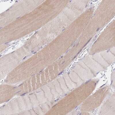 Immunohistochemistry-Paraffin: UBXN7 Antibody [NBP2-47588]