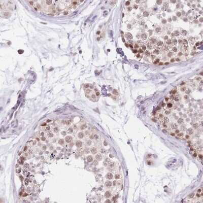 Immunohistochemistry-Paraffin: UBXN7 Antibody [NBP2-47588]