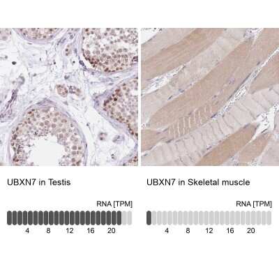 Immunohistochemistry-Paraffin: UBXN7 Antibody [NBP2-47588]