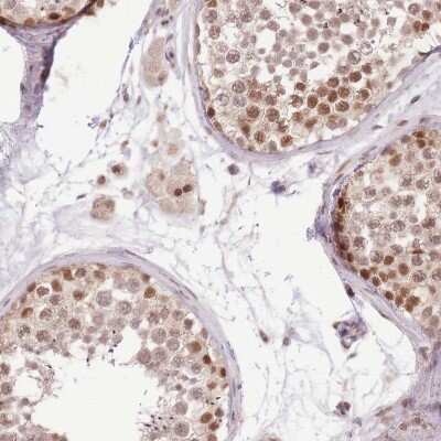 Immunohistochemistry-Paraffin: UBXN7 Antibody [NBP2-47589]