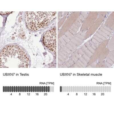 Immunohistochemistry-Paraffin: UBXN7 Antibody [NBP2-47589]