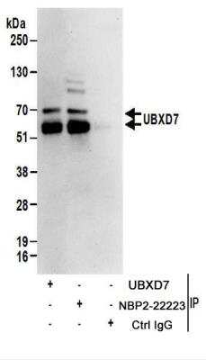 Immunoprecipitation: UBXN7 Antibody [NBP2-22223]
