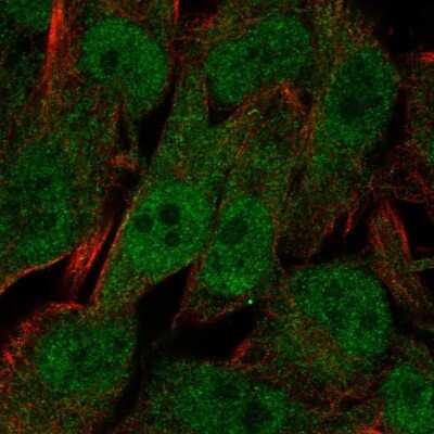 Immunocytochemistry/ Immunofluorescence: UBXN8 Antibody [NBP2-57881]