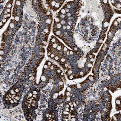 Immunohistochemistry-Paraffin: UBXN8 Antibody [NBP2-76517]