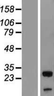 Western Blot: UBXN8 Overexpression Lysate [NBL1-17574]