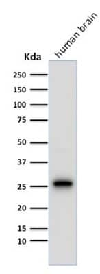 Western Blot: UCH-L1/PGP9.5 Antibody (13C4) [NBP2-29420]