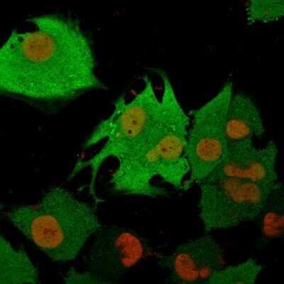 Immunocytochemistry/ Immunofluorescence: UCH-L1/PGP9.5 Antibody (31A3) - Azide and BSA Free [NBP2-33130]