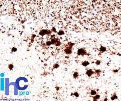 Immunohistochemistry-Paraffin: UCH-L1/PGP9.5 Antibody (31A3) - IHC-Prediluted [NBP2-45339]