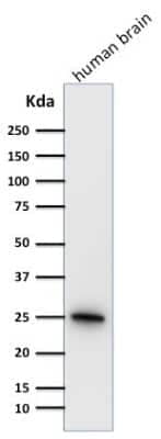 Western Blot: UCH-L1/PGP9.5 Antibody (31A3) [NB600-1160]