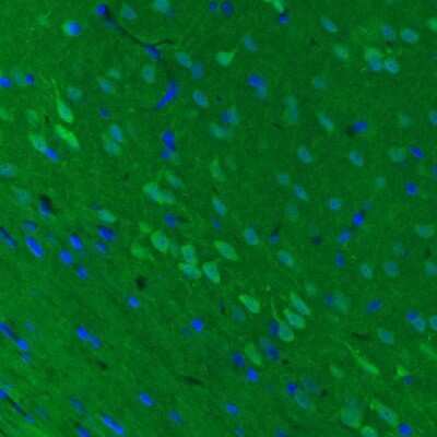 Immunohistochemistry: UCH-L1/PGP9.5 Antibody (CL3210) [NBP2-46621]