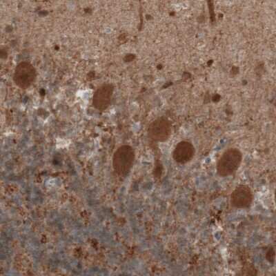 Immunohistochemistry-Paraffin: UCH-L1/PGP9.5 Antibody (CL3210) [NBP2-46621]