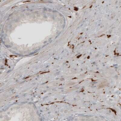 Immunohistochemistry-Paraffin: UCH-L1/PGP9.5 Antibody (CL3210) [NBP2-46621]