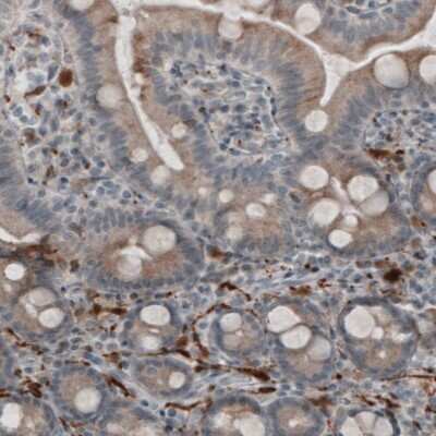 Immunohistochemistry-Paraffin: UCH-L1/PGP9.5 Antibody (CL3210) [NBP2-46621]