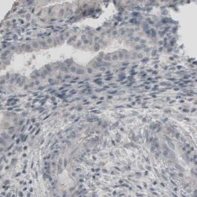 Immunohistochemistry-Paraffin: UCH-L1/PGP9.5 Antibody (CL3210) [NBP2-46621]