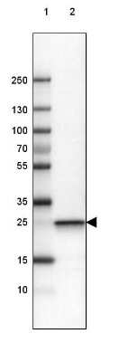 Western Blot: UCH-L1/PGP9.5 Antibody (CL3210) [NBP2-46621]