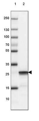Western Blot: UCH-L1/PGP9.5 Antibody (CL3210) [NBP2-46621]