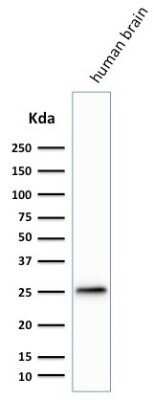 Western Blot: UCH-L1/PGP9.5 Antibody (SPM574)Azide and BSA Free [NBP2-34807]