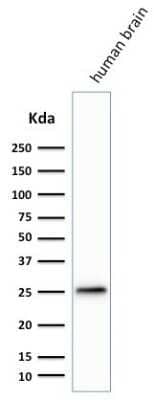 Western Blot: UCH-L1/PGP9.5 Antibody (SPM574) [NBP2-32895]