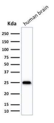 Western Blot: UCH-L1/PGP9.5 Antibody (SPM575)Azide and BSA Free [NBP2-34808]