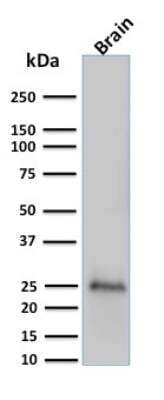 Western Blot: UCH-L1/PGP9.5 Antibody (UCHL1/775)Azide and BSA Free [NBP2-47932]