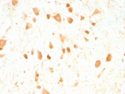 Immunohistochemistry-Paraffin: UCH-L1/PGP9.5 Antibody (UCHL1/775) - IHC-Prediluted [NBP2-48315]