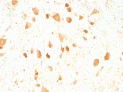 Immunohistochemistry-Paraffin: UCH-L1/PGP9.5 Antibody (UCHL1/775) [NBP2-44795]