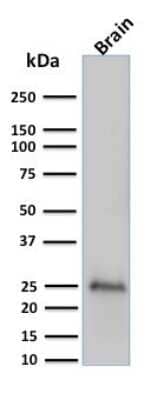 Western Blot: UCH-L1/PGP9.5 Antibody (UCHL1/775) [NBP2-44795]