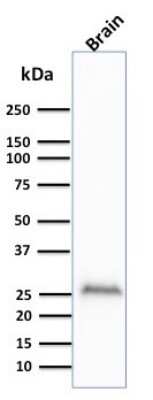 Western Blot: UCH-L1/PGP9.5 Antibody (UCHL1/841) [NBP2-44796]