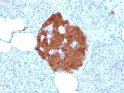 Immunohistochemistry-Paraffin: UCH-L1/PGP9.5 Antibody (rUCHL1/775) - Azide and BSA Free [NBP2-75775]