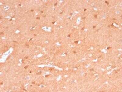 Immunohistochemistry-Paraffin: UCH-L1/PGP9.5 Antibody (rUCHL1/775) - Azide and BSA Free [NBP2-75775]