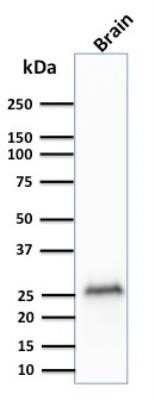 Western Blot: UCH-L1/PGP9.5 Antibody (rUCHL1/775)Azide and BSA Free [NBP2-75775]