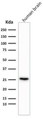 Western Blot: UCH-L1/PGP9.5 Antibody (rUCHL1/775)Azide and BSA Free [NBP2-75775]