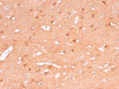 Immunohistochemistry-Paraffin: UCH-L1/PGP9.5 Antibody (rUCHL1/775) [NBP2-75773]